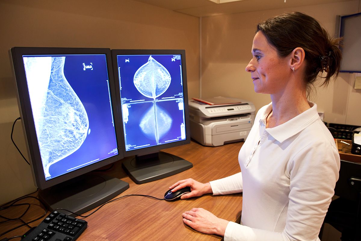 detección precoz cancer de mama