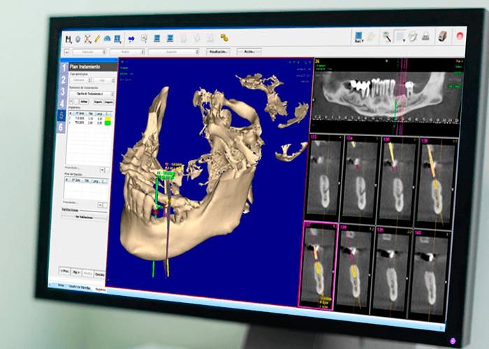 Radiología dental